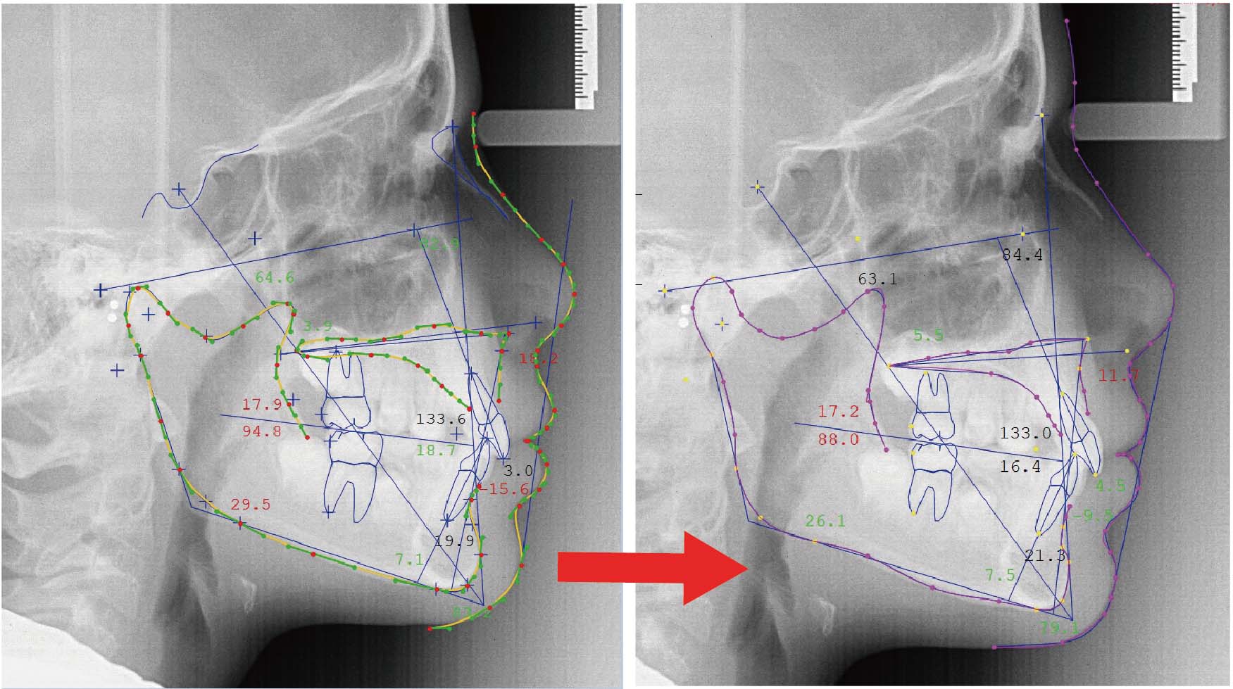 新機能のページへ